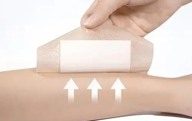 Zhuopu Medical participa con &eacute;xito en exposiciones internacionales sobre el cuidado de heridas 2026: fortalecimiento de asociaciones globales para ap&oacute;sitos para heridas OEM